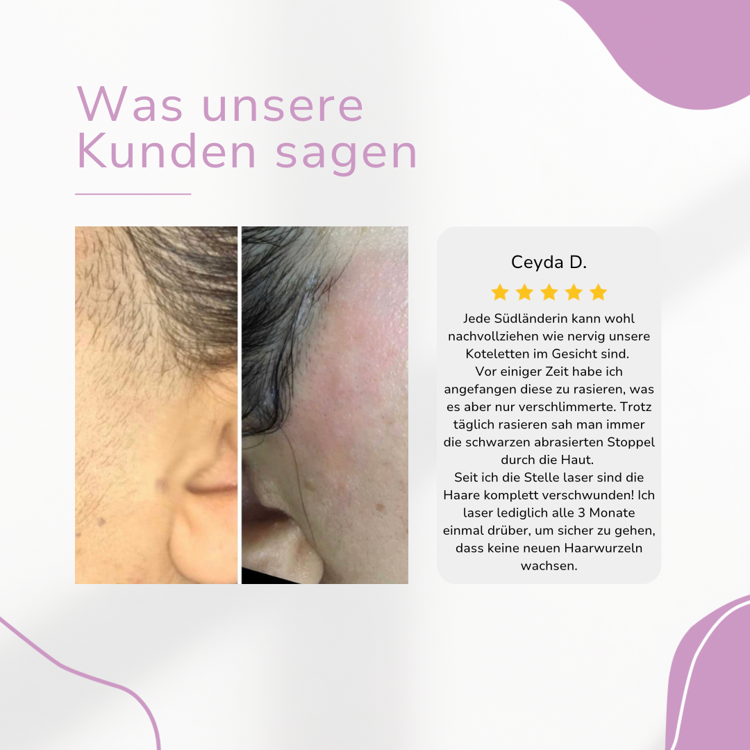 Venzani Lumi IPL Hair Remover I Den ledende laser hårfjerning for hjemmet