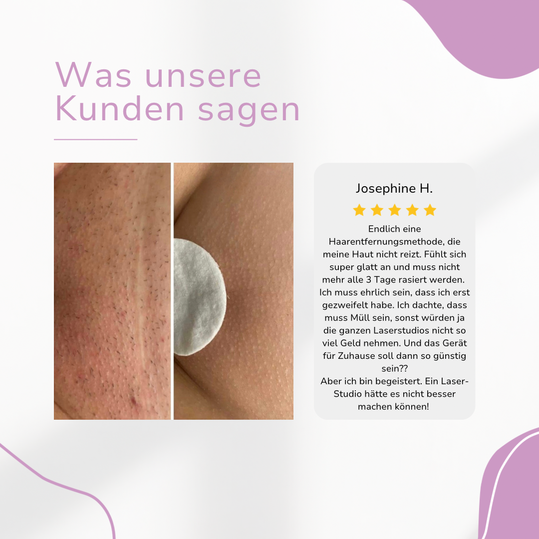 Venzani Lumi IPL Hair Remover I Den ledende laser hårfjerning for hjemmet