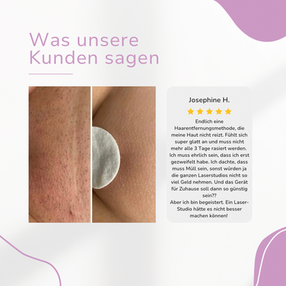 Venzani Lumi IPL Hair Remover I Den ledende laser hårfjerning for hjemmet
