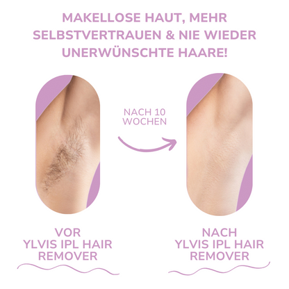 Venzani Lumi IPL Hair Remover I Den ledende laser hårfjerning for hjemmet